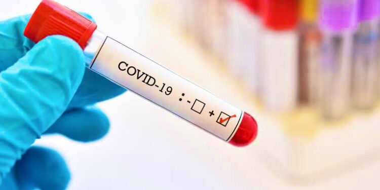 Se reduce en 22% ocupación hospitalaria; este día con 59.6% global