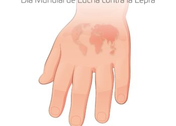 Intensifica SSO acciones en la lucha contra la lepra
