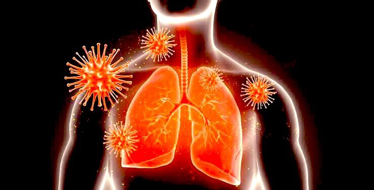 Registran los SSO 11 decesos y mil 066 casos nuevos de COVID-19