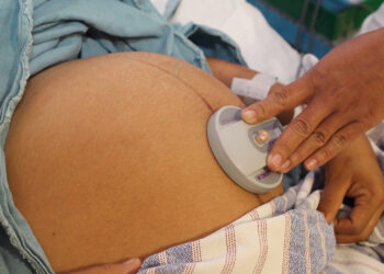 Ácido fólico, primordial para un embarazo saludable: SSO