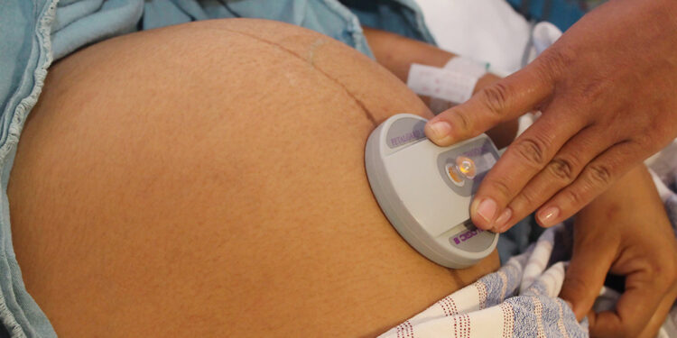 Ácido fólico, primordial para un embarazo saludable: SSO