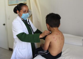 Cuantifica Oaxaca baja incidencia de casos de varicela: SSO