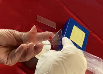 Refuerzan los SSO acciones contra el paludismo en la entidad