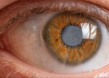 Realizarán Jornada de Detección de Catarata