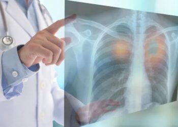 Causas por las que se pagaron más seguros de vida