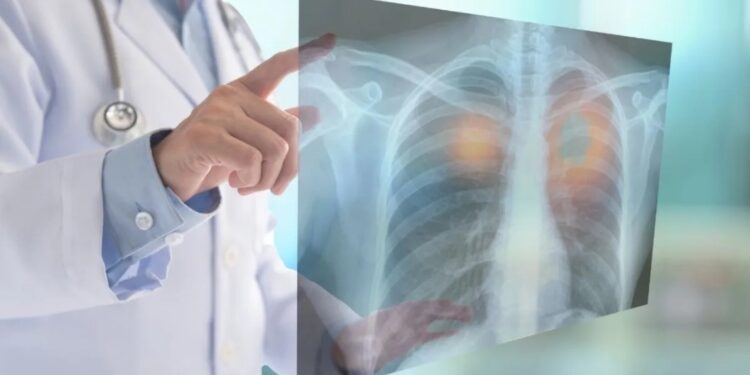 Causas por las que se pagaron más seguros de vida