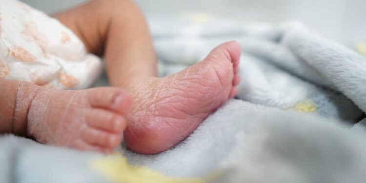 Talla baja y cuello ancho pueden ser señales del Síndrome de Turner: SSO