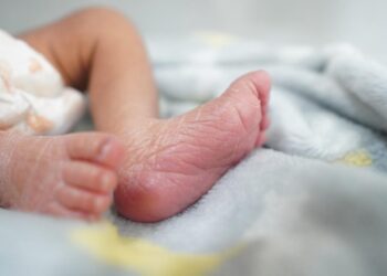 Ausencia de ácido fólico en la gestación puede causar espina bífida en recién nacidos: SSO